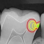 Why are dental x-rays important
