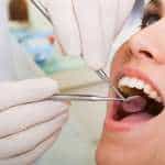 Full Mouth Dental Restoration Hoover Alabama