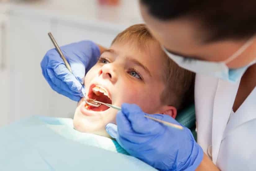 Dental Cavities Fillings And Hoover AL Dentists