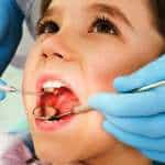 Why Children Need Cavities Filled?