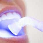 What is Laser Dentistry?