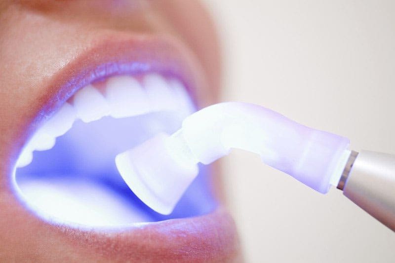 Hoover Laser Dentistry