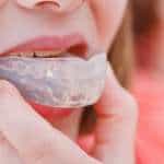 Protecting Your Children's Teeth During Sports With Mouthguards