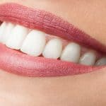 Porcelain Veneers Hoover AL