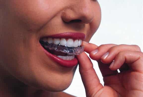 No matter how diligently you care for your teeth during the day, you might be harming your teeth overnight. Are You Grinding Your Teeth While You Sleep?