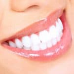 Should I whitening My Teeth?