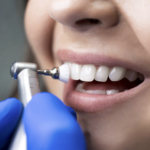 Be sure to schedule regular dental appointments with Sampson Dentistry to keep your teeth and gums healthy.